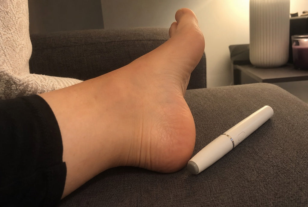 Foto di una cliente: tallone prima e dopo